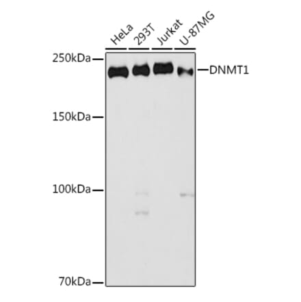 Western Blot - Anti-Dnmt1 Antibody (A307589) - Antibodies.com