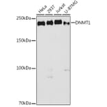 Western Blot - Anti-Dnmt1 Antibody (A307589) - Antibodies.com