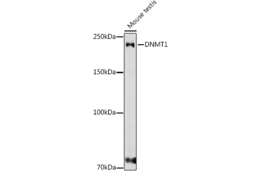 Western Blot - Anti-Dnmt1 Antibody (A307589) - Antibodies.com