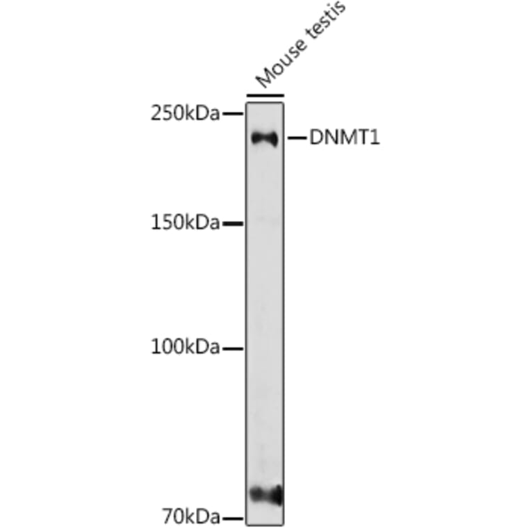 Western Blot - Anti-Dnmt1 Antibody (A307589) - Antibodies.com