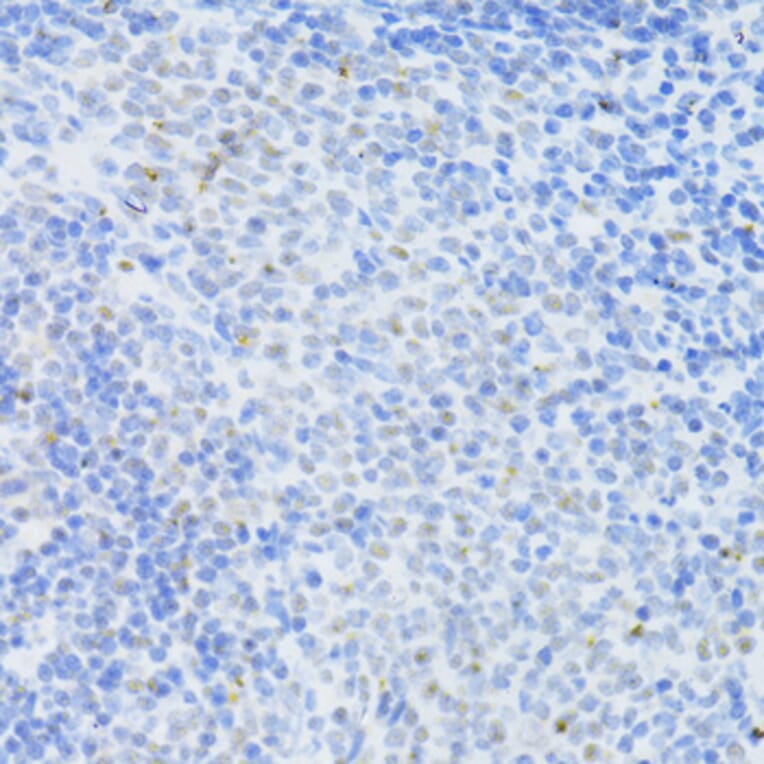 Immunohistochemistry - Anti-Dnmt1 Antibody (A307589) - Antibodies.com