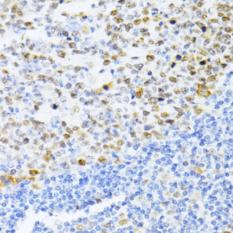 Immunohistochemistry - Anti-Dnmt1 Antibody (A307589) - Antibodies.com