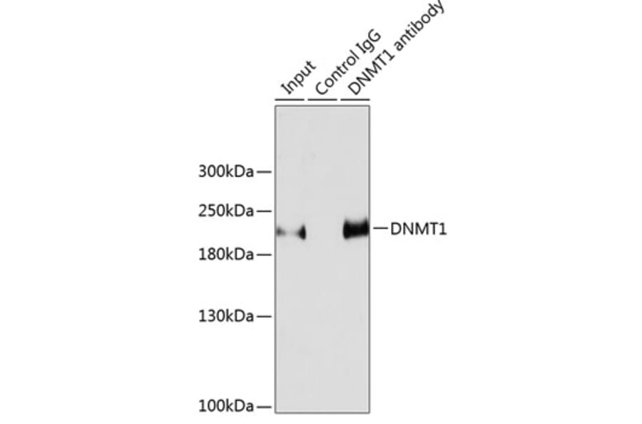 Western Blot - Anti-Dnmt1 Antibody (A307589) - Antibodies.com