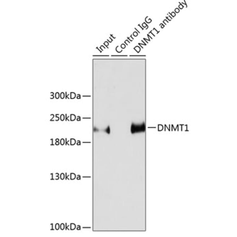 Western Blot - Anti-Dnmt1 Antibody (A307589) - Antibodies.com