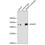 Western Blot - Anti-Dnmt1 Antibody (A307589) - Antibodies.com