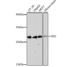Western Blot - Anti-GSC Antibody [ARC2343] (A307590) - Antibodies.com