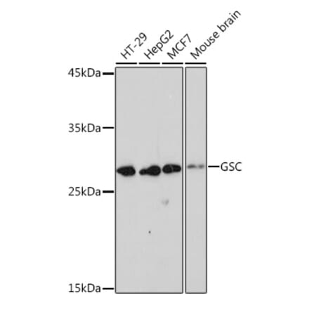 Western Blot - Anti-GSC Antibody [ARC2343] (A307590) - Antibodies.com