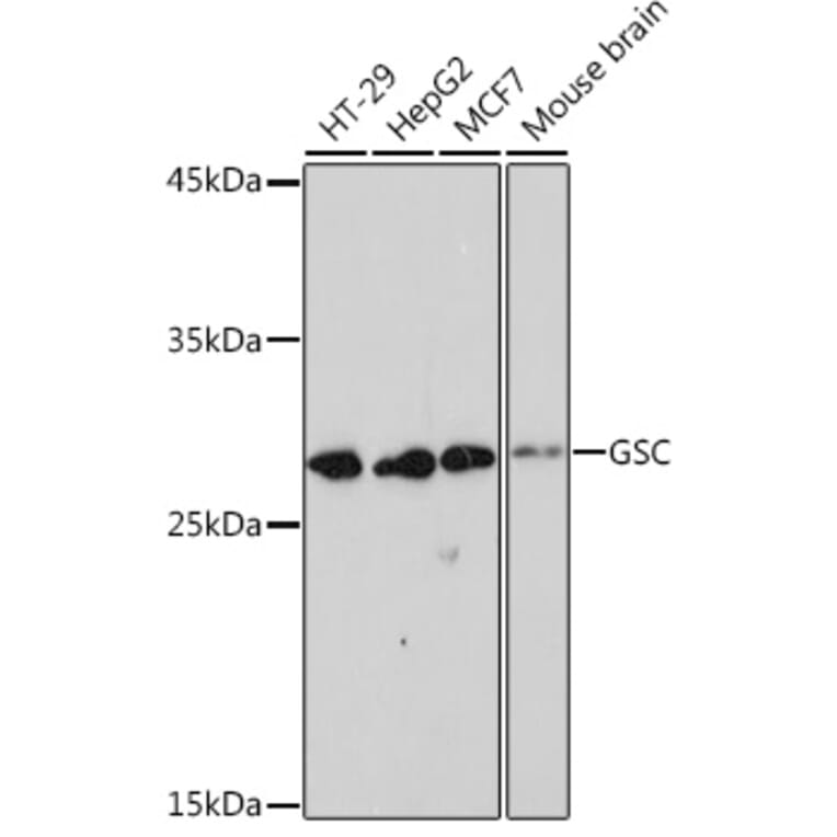 Western Blot - Anti-GSC Antibody [ARC2343] (A307590) - Antibodies.com