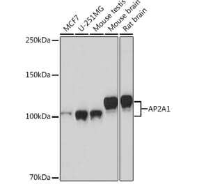 Western Blot - Anti-AP-2 complex subunit alpha-1 Antibody [ARC0998] (A307591) - Antibodies.com