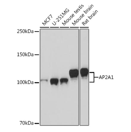 Western Blot - Anti-AP-2 complex subunit alpha-1 Antibody [ARC0998] (A307591) - Antibodies.com