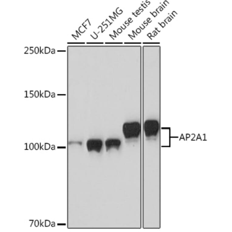 Western Blot - Anti-AP-2 complex subunit alpha-1 Antibody [ARC0998] (A307591) - Antibodies.com