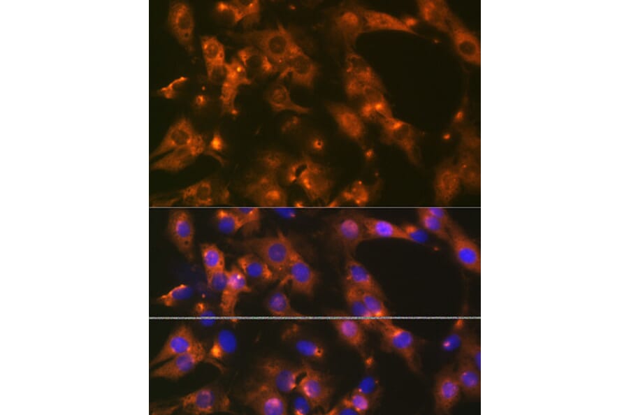 Immunofluorescence - Anti-AP-2 complex subunit alpha-1 Antibody [ARC0998] (A307591) - Antibodies.com