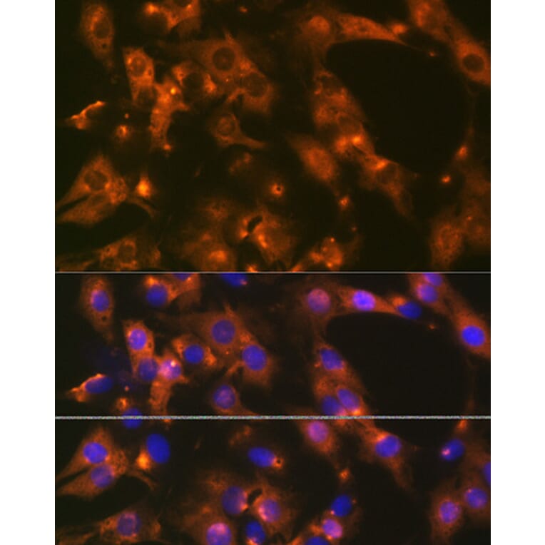 Immunofluorescence - Anti-AP-2 complex subunit alpha-1 Antibody [ARC0998] (A307591) - Antibodies.com