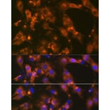 Immunofluorescence - Anti-AP-2 complex subunit alpha-1 Antibody [ARC0998] (A307591) - Antibodies.com