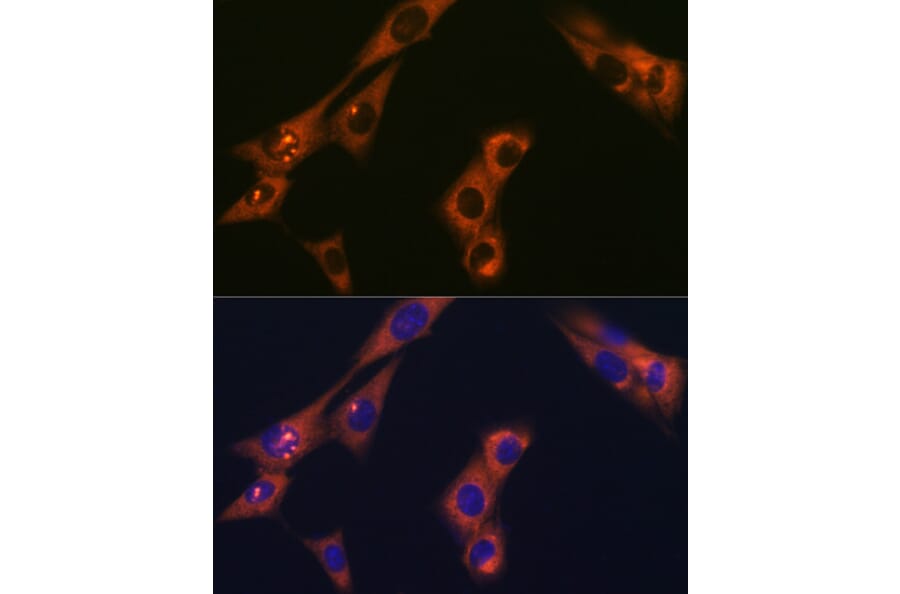 Immunofluorescence - Anti-AP-2 complex subunit alpha-1 Antibody [ARC0998] (A307591) - Antibodies.com
