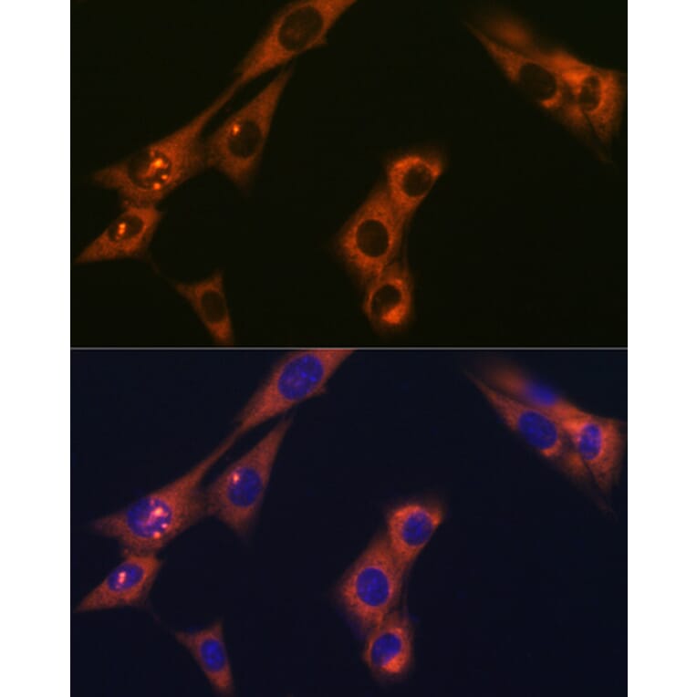 Immunofluorescence - Anti-AP-2 complex subunit alpha-1 Antibody [ARC0998] (A307591) - Antibodies.com