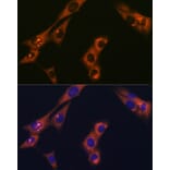 Immunofluorescence - Anti-AP-2 complex subunit alpha-1 Antibody [ARC0998] (A307591) - Antibodies.com