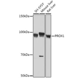 Western Blot - Anti-PROX1 Antibody [ARC1391] (A307592) - Antibodies.com