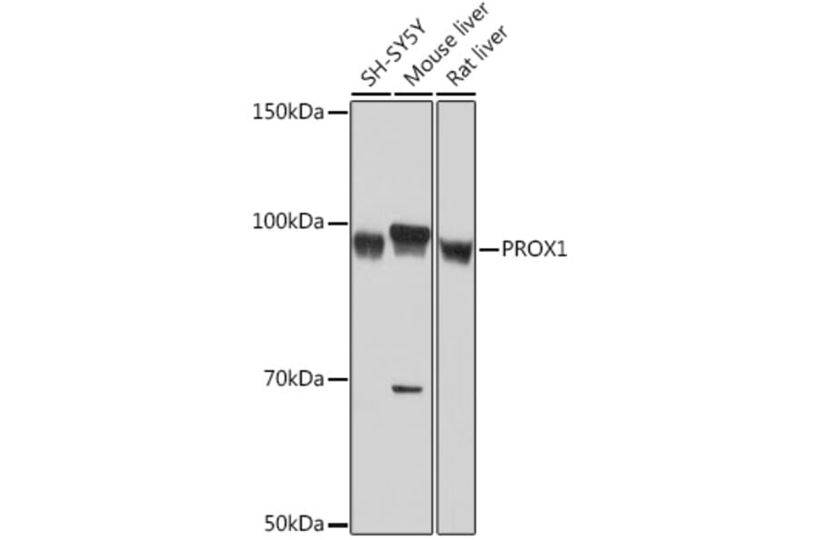 Western Blot - Anti-PROX1 Antibody [ARC1391] (A307592) - Antibodies.com