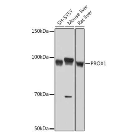 Western Blot - Anti-PROX1 Antibody [ARC1391] (A307592) - Antibodies.com