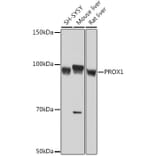 Western Blot - Anti-PROX1 Antibody [ARC1391] (A307592) - Antibodies.com