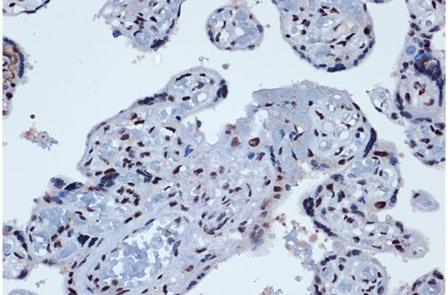 Immunohistochemistry - Anti-PROX1 Antibody [ARC1391] (A307592) - Antibodies.com