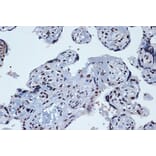 Immunohistochemistry - Anti-PROX1 Antibody [ARC1391] (A307592) - Antibodies.com