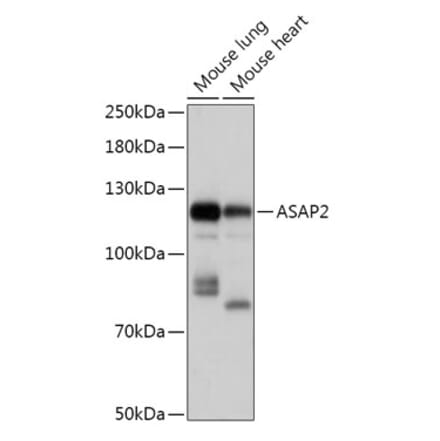 Western Blot - Anti-ASAP2 Antibody (A307593) - Antibodies.com