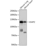 Western Blot - Anti-ASAP2 Antibody (A307593) - Antibodies.com