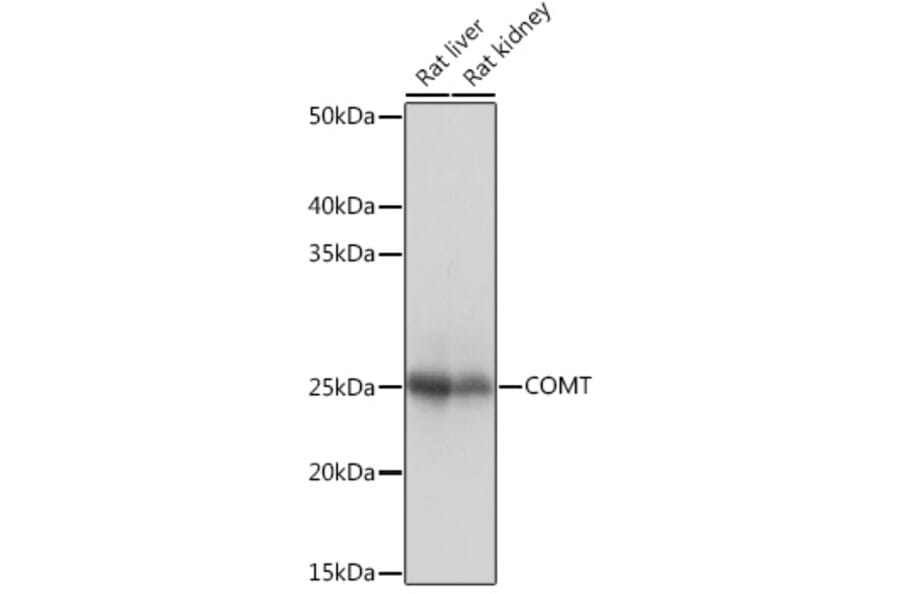 Western Blot - Anti-COMT Antibody [ARC1006] (A307594) - Antibodies.com