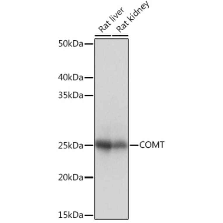 Western Blot - Anti-COMT Antibody [ARC1006] (A307594) - Antibodies.com