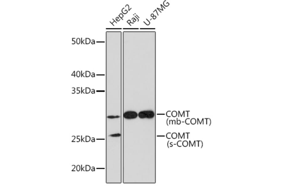 Western Blot - Anti-COMT Antibody [ARC1006] (A307594) - Antibodies.com