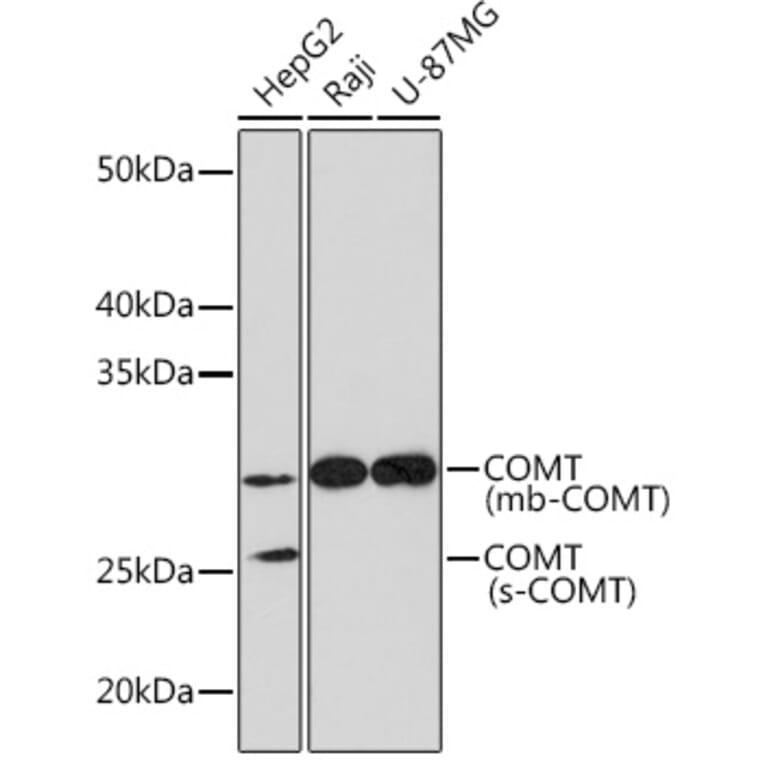 Western Blot - Anti-COMT Antibody [ARC1006] (A307594) - Antibodies.com