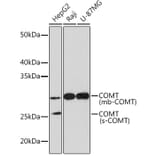 Western Blot - Anti-COMT Antibody [ARC1006] (A307594) - Antibodies.com