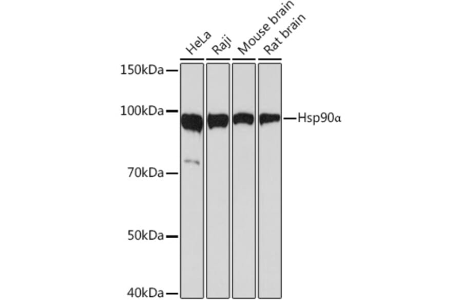 Western Blot - Anti-Hsp90 alpha Antibody [ARC1167] (A307595) - Antibodies.com
