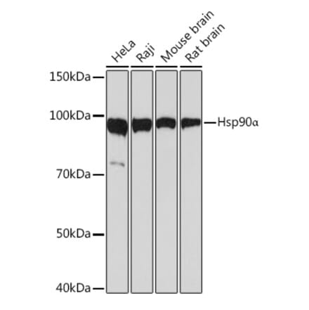 Western Blot - Anti-Hsp90 alpha Antibody [ARC1167] (A307595) - Antibodies.com