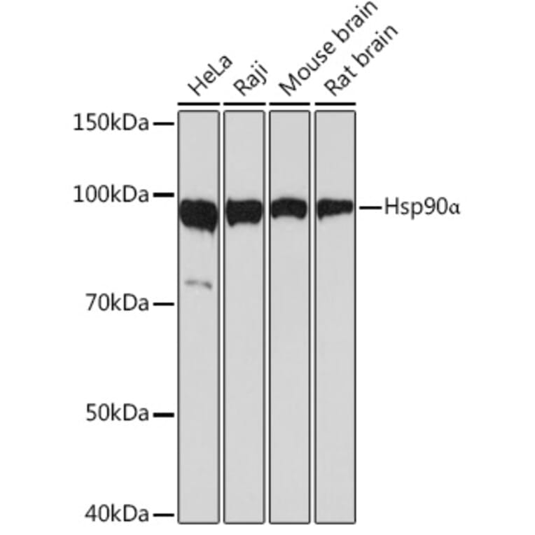 Western Blot - Anti-Hsp90 alpha Antibody [ARC1167] (A307595) - Antibodies.com