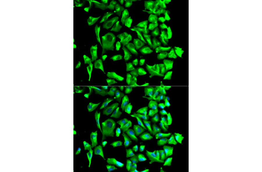 Immunofluorescence - Anti-Hsp90 beta Antibody (A307597) - Antibodies.com