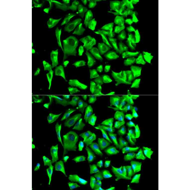 Immunofluorescence - Anti-Hsp90 beta Antibody (A307597) - Antibodies.com