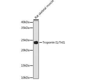 Western Blot - Anti-TNNI1 Antibody [ARC1687] (A307600) - Antibodies.com