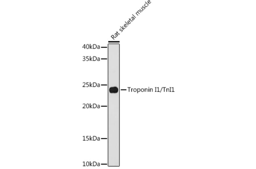 Western Blot - Anti-TNNI1 Antibody [ARC1687] (A307600) - Antibodies.com
