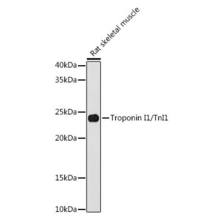 Western Blot - Anti-TNNI1 Antibody [ARC1687] (A307600) - Antibodies.com