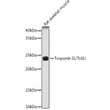 Western Blot - Anti-TNNI1 Antibody [ARC1687] (A307600) - Antibodies.com