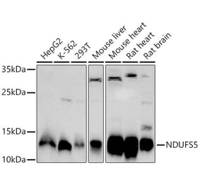 Western Blot - Anti-NDUFS5 Antibody (A307601) - Antibodies.com