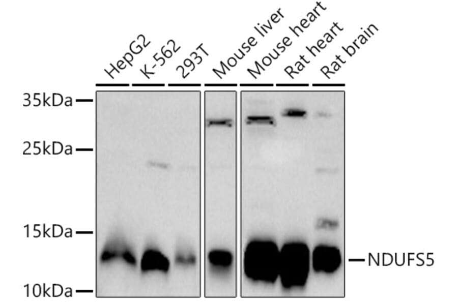 Western Blot - Anti-NDUFS5 Antibody (A307601) - Antibodies.com