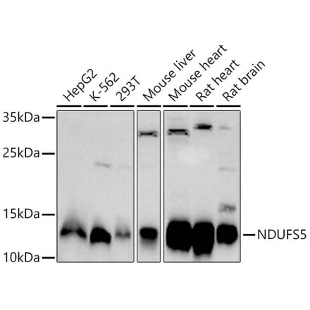 Western Blot - Anti-NDUFS5 Antibody (A307601) - Antibodies.com