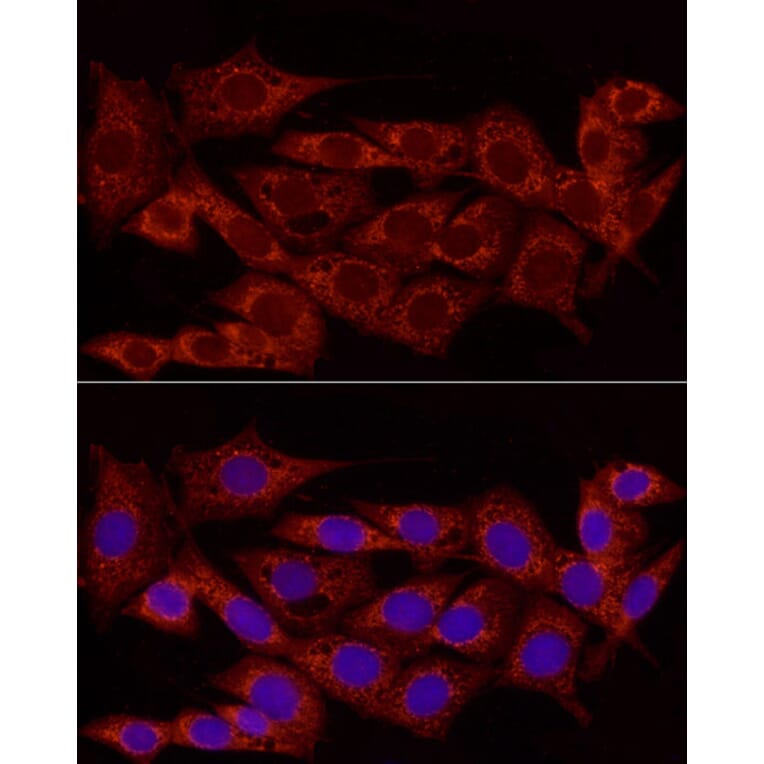 Immunofluorescence - Anti-NDUFS5 Antibody (A307601) - Antibodies.com