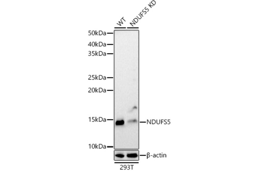Western Blot - Anti-NDUFS5 Antibody (A307602) - Antibodies.com
