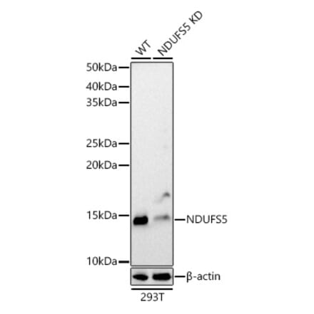 Western Blot - Anti-NDUFS5 Antibody (A307602) - Antibodies.com