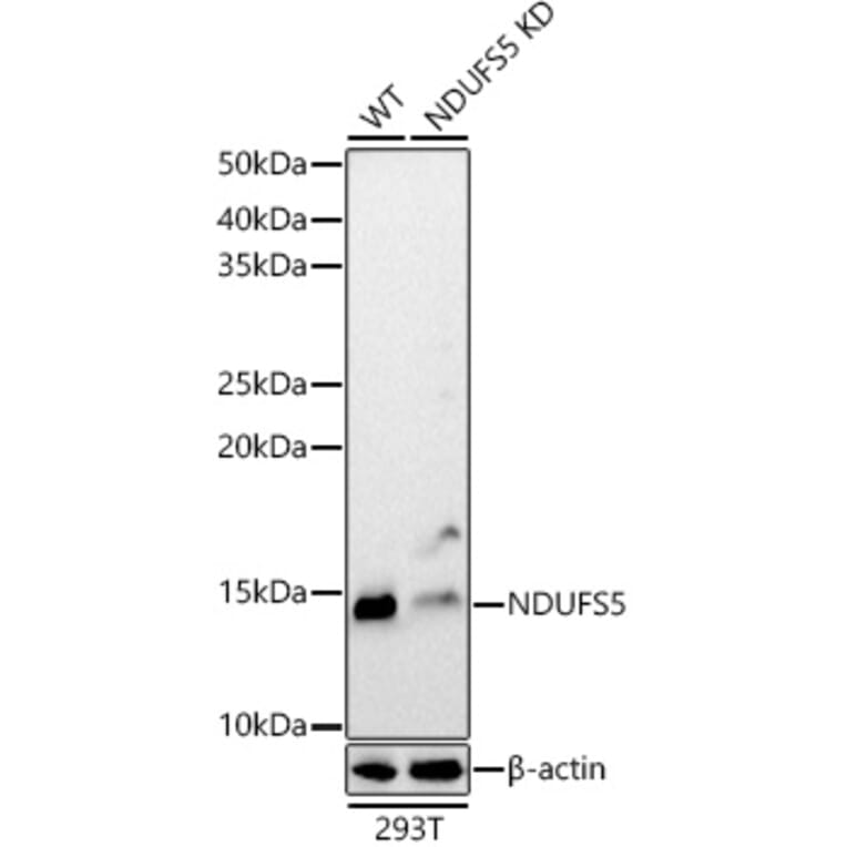 Western Blot - Anti-NDUFS5 Antibody (A307602) - Antibodies.com